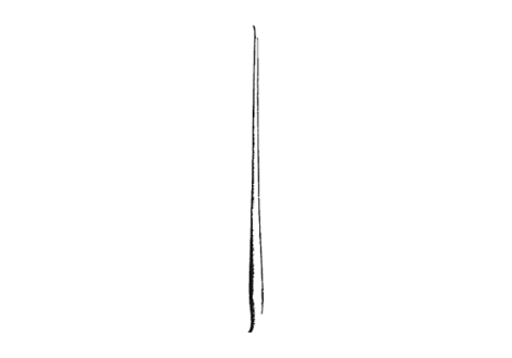 Moldestad Retractor
